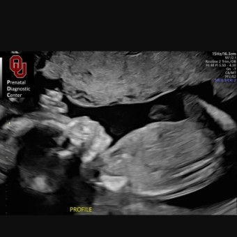 Lacy's Baby Registry Photo.