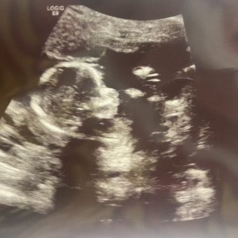 Raquel's Baby Registry Photo.