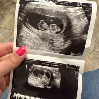 Baby Girl #2 Photo.