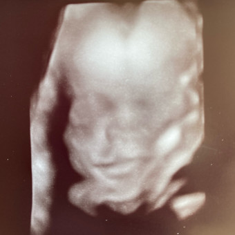 Baby Bethea Registry Photo.