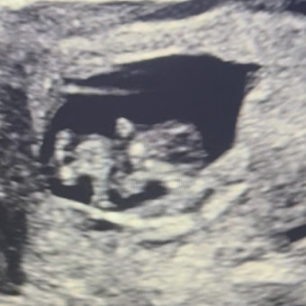 Alexyss & Jordan’s Baby Registry Photo.
