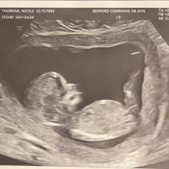 Thurkins Baby Registry Photo.