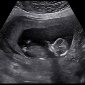Kristen's Baby Registry Photo.
