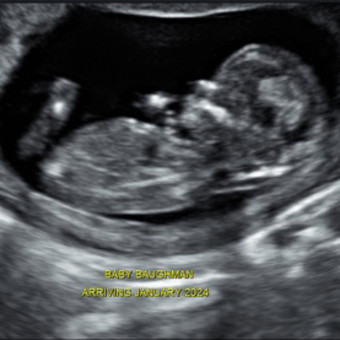 Kyrstin's Baby Registry Photo.