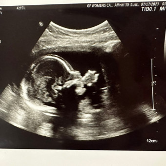 Kyrie's Baby Registry Photo.