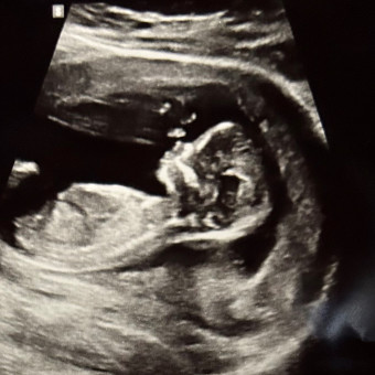 Hayley's Baby Registry Photo.