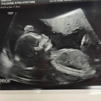 Kyra's Baby Registry Photo.