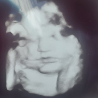Alyssa's Baby Registry Photo.