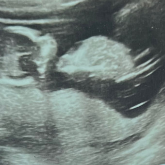LaRae’ Neal’s Baby Registry Photo.