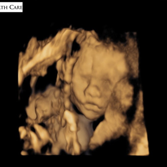 Brianna & Shawn's Baby Registry Photo.
