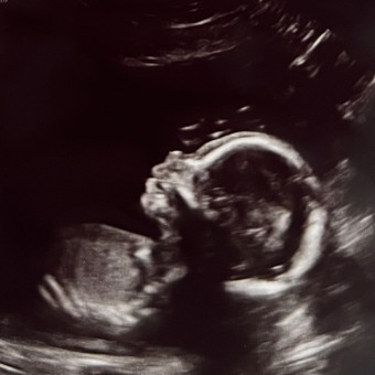 Lexy & Austin’s Baby Registry Photo.