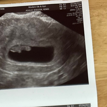 Chelsea's Baby Registry Photo.