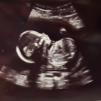 Ashlyn and Zacks Baby Registry Photo.