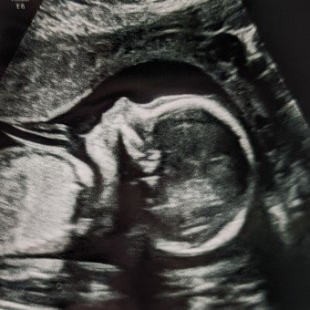 Baby B Registry Photo.
