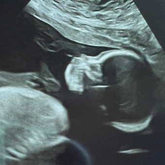 Madison & Hayden Cupples’ Baby Registry Photo.