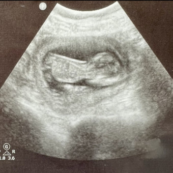 Bianca and Damien’s Baby Registry Photo.