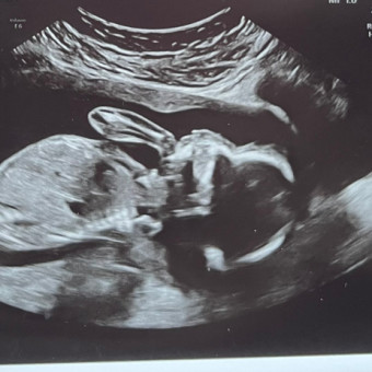 Mattie's Baby Registry Photo.