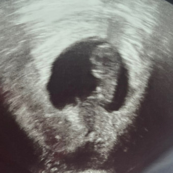 Emily and Gaige Baby Registry Photo.