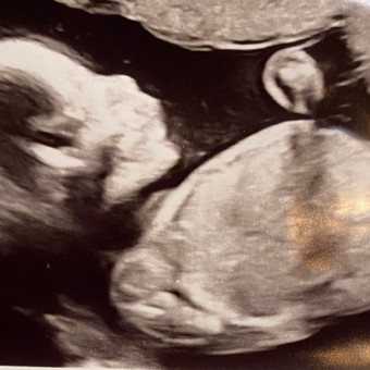 Kelsey & Taylor’s Baby Registry Photo.