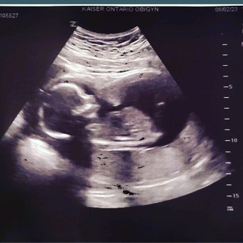Marsia's Baby Registry Photo.
