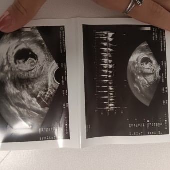 Kenzie's Baby Registry Photo.