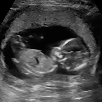 Ali's Baby Registry Photo.