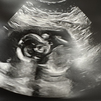 Ashley & Merritt’s Baby Registry Photo.