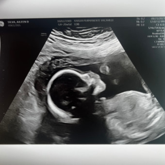 Aileen's Baby Registry Photo.