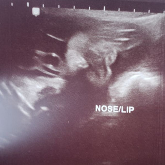 Baby Sophia Photo.
