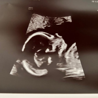 Kiley & Jackson’s Baby Registry Photo.