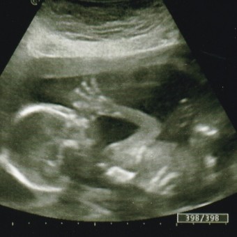 Kayla & Parker Baby #2 Photo.