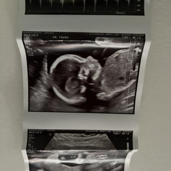 Renee's Baby Registry Photo.