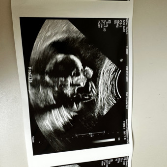 Skyler's Baby Registry Photo.