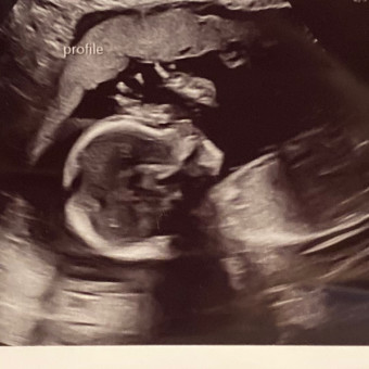 Williamson Ultrasound