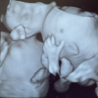 Haag Twins Baby Registry Photo.