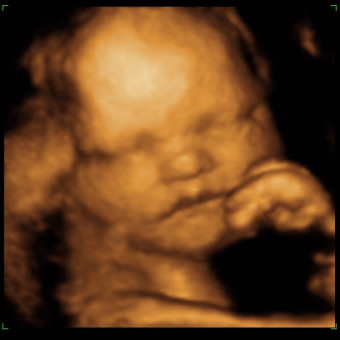 Baby Girl Warren’s Baby Registry Photo.