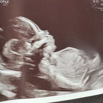 Alexcia's Baby Registry Photo.
