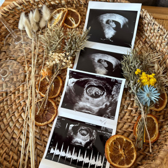 Diana's Baby Registry Photo.