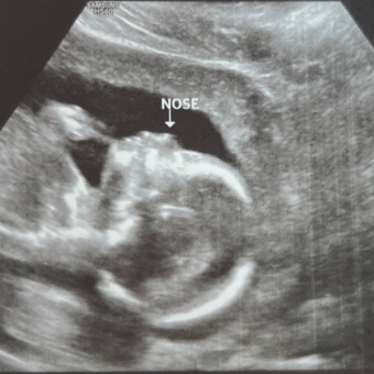 Manee's Baby Registry Photo.