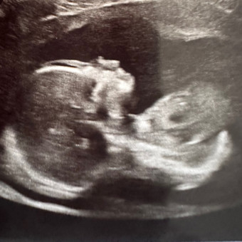 Meagan's Baby Registry Photo.