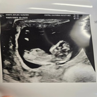 Skylar's Baby Registry Photo.