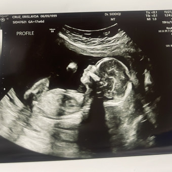 Xiomara's Baby Registry Photo.