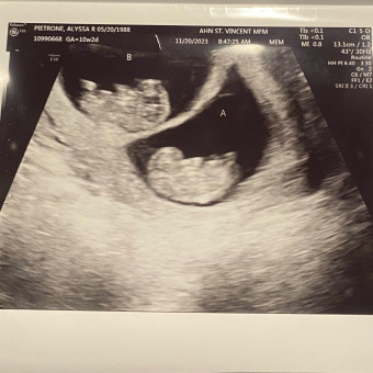 Alyssa's Baby Registry Photo.