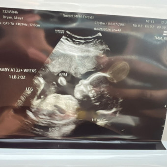 Akaya's Baby Registry Photo.