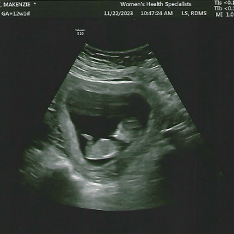 MaKenzie's Baby Registry Photo.