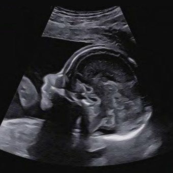 Zinia's Baby Registry Photo.