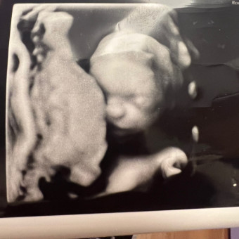 Alexa's Baby Registry Photo.