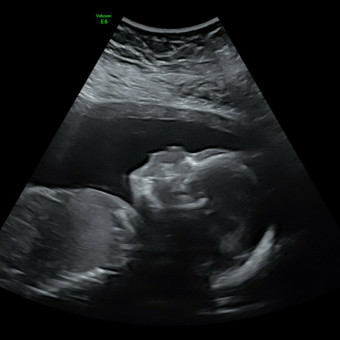 Harnden Baby Registry Photo.