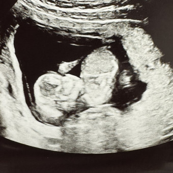 Amelia & Nick Danesi's Baby Registry Photo.