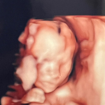 Luisanel's Baby Registry Photo.